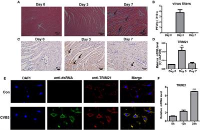 TRIM21 Restricts Coxsackievirus B3 Replication, Cardiac and Pancreatic Injury via Interacting With MAVS and Positively Regulating IRF3-Mediated Type-I Interferon Production